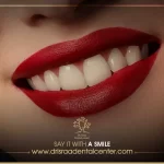 هوليود سمايل المتحركة – احصل على ابتسامة جذابة