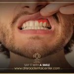 ما هو أفضل علاج لالتهاب اللثة الحاد – وكيف تقي نفسك من هذه المشكلة؟