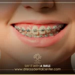 تعرف على فوائد تقويم الاسنان للوجه والفك