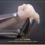 سعر خلع ضرس العقل ـ ومتى نحتاج إلى خلع ضرس العقل؟