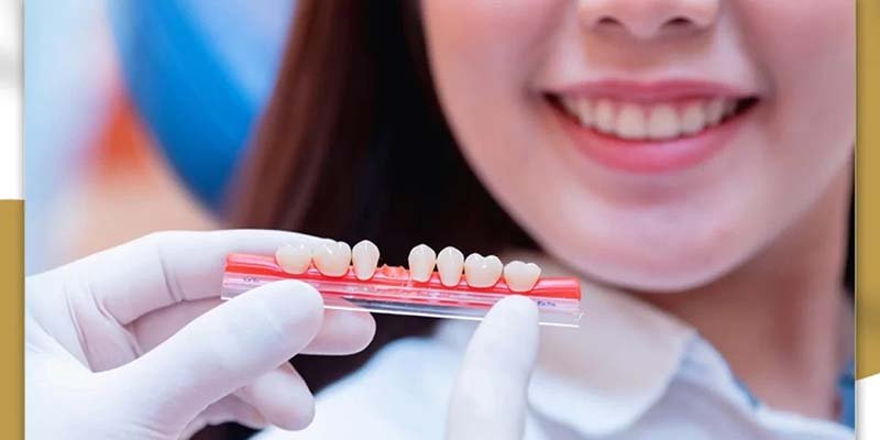 شكل طربوش الأسنان الأمامية