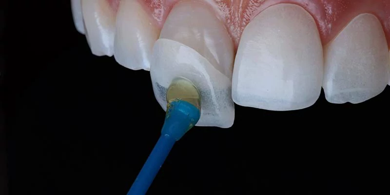 علاج أضرار زراعة الاسنان 